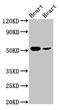 Integrin Linked Kinase antibody, CSB-PA00999A0Rb, Cusabio, Western Blot image 