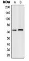 G Protein-Coupled Receptor Kinase 7 antibody, LS-C353633, Lifespan Biosciences, Western Blot image 