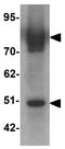 Solute Carrier Family 39 Member 6 antibody, GTX85131, GeneTex, Western Blot image 