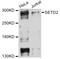 SET Domain Containing 2, Histone Lysine Methyltransferase antibody, abx126537, Abbexa, Western Blot image 