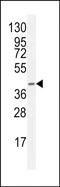 Factor VIII intron 22 protein antibody, PA5-48188, Invitrogen Antibodies, Western Blot image 
