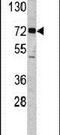 Elongator Acetyltransferase Complex Subunit 2 antibody, PA5-12515, Invitrogen Antibodies, Western Blot image 