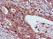 THO Complex 3 antibody, LS-C399613, Lifespan Biosciences, Immunohistochemistry paraffin image 