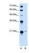 T-Complex 10 Like antibody, NBP1-52846, Novus Biologicals, Western Blot image 