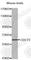 Cell Division Cycle 73 antibody, A0636, ABclonal Technology, Western Blot image 