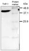 Actin Alpha 1, Skeletal Muscle antibody, MA5-11869, Invitrogen Antibodies, Western Blot image 