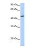 Ankyrin Repeat Domain 65 antibody, NBP1-91320, Novus Biologicals, Western Blot image 