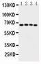 Calcium/Calmodulin Dependent Protein Kinase Kinase 2 antibody, PA5-78909, Invitrogen Antibodies, Western Blot image 