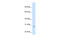 Enoyl-CoA hydratase, mitochondrial antibody, 30-101, ProSci, Western Blot image 