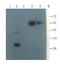 COL10A1 Chain Collagen Type X alpha 1 antibody, GTX37732, GeneTex, Western Blot image 