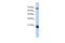 Mitochondrial intermembrane space import and assembly protein 40 antibody, GTX45825, GeneTex, Western Blot image 