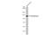 Hexokinase 2 antibody, GTX111525, GeneTex, Western Blot image 