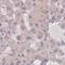 Transcription Factor 20 antibody, NBP2-31968, Novus Biologicals, Immunohistochemistry paraffin image 