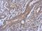 tRNA dimethylallyltransferase, mitochondrial antibody, PA5-31715, Invitrogen Antibodies, Immunohistochemistry paraffin image 