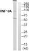 E3 ubiquitin-protein ligase RNF19A antibody, PA5-39154, Invitrogen Antibodies, Western Blot image 