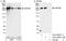 Centrosomal Protein 290 antibody, A301-659A, Bethyl Labs, Western Blot image 