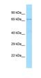 Thioredoxin Reductase 3 antibody, orb326509, Biorbyt, Western Blot image 