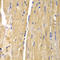 Solute Carrier Family 25 Member 13 antibody, STJ28412, St John