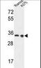 Lactate Dehydrogenase A antibody, LS-C165730, Lifespan Biosciences, Western Blot image 