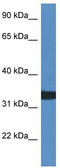 Alkaline Ceramidase 1 antibody, TA343069, Origene, Western Blot image 