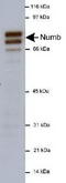 NUMB Endocytic Adaptor Protein antibody, TA336652, Origene, Western Blot image 