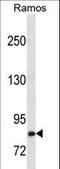 Hepatocyte Growth Factor antibody, LS-C159825, Lifespan Biosciences, Western Blot image 