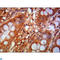 Chromodomain Helicase DNA Binding Protein 3 antibody, LS-C813050, Lifespan Biosciences, Immunohistochemistry paraffin image 
