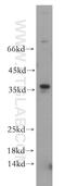 MAX Dimerization Protein MLX antibody, 12042-1-AP, Proteintech Group, Western Blot image 