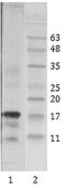 Lysine Acetyltransferase 5 antibody, MA1-71509, Invitrogen Antibodies, Western Blot image 