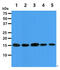 Eukaryotic Translation Initiation Factor 5A antibody, GTX57567, GeneTex, Western Blot image 