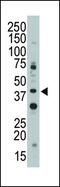 CD33 Molecule antibody, PA5-11674, Invitrogen Antibodies, Western Blot image 