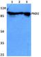 Protein Kinase D2 antibody, A04056, Boster Biological Technology, Western Blot image 