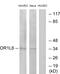 Olfactory Receptor Family 1 Subfamily L Member 6 antibody, PA5-38207, Invitrogen Antibodies, Western Blot image 