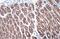 Cadherin 1 antibody, GTX100443, GeneTex, Immunohistochemistry paraffin image 