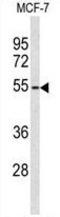 ADAM Like Decysin 1 antibody, GTX80550, GeneTex, Western Blot image 