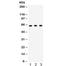 Checkpoint Kinase 2 antibody, R31854, NSJ Bioreagents, Western Blot image 