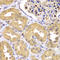 Leucine Zipper Like Transcription Regulator 1 antibody, STJ29489, St John