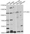 Proprotein Convertase Subtilisin/Kexin Type 5 antibody, STJ27403, St John