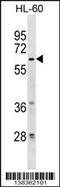 Zinc Finger Protein 317 antibody, 59-778, ProSci, Western Blot image 
