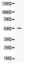 Nucleobindin 2 antibody, PB9876, Boster Biological Technology, Western Blot image 