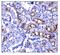Prominin-1 antibody, A01767-4, Boster Biological Technology, Immunohistochemistry paraffin image 