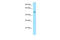 Sorting Nexin 5 antibody, ARP55049_P050, Aviva Systems Biology, Western Blot image 