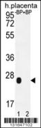 Olfactory Receptor Family 2 Subfamily J Member 3 antibody, 56-173, ProSci, Western Blot image 