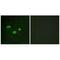 DNA (cytosine-5)-methyltransferase 3B antibody, A00319, Boster Biological Technology, Immunofluorescence image 