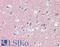 Reticulon 3 antibody, LS-B15478, Lifespan Biosciences, Immunohistochemistry paraffin image 