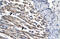 Jumonji Domain Containing 8 antibody, 27-461, ProSci, Immunohistochemistry paraffin image 