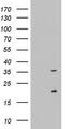 NUS1 Dehydrodolichyl Diphosphate Synthase Subunit antibody, M08264, Boster Biological Technology, Western Blot image 