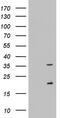 Nogo-B receptor antibody, M08264, Boster Biological Technology, Western Blot image 