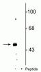 Gamma-Aminobutyric Acid Type A Receptor Beta3 Subunit antibody, P02617, Boster Biological Technology, Western Blot image 