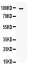 Toll-like receptor 5 antibody, PB9451, Boster Biological Technology, Western Blot image 